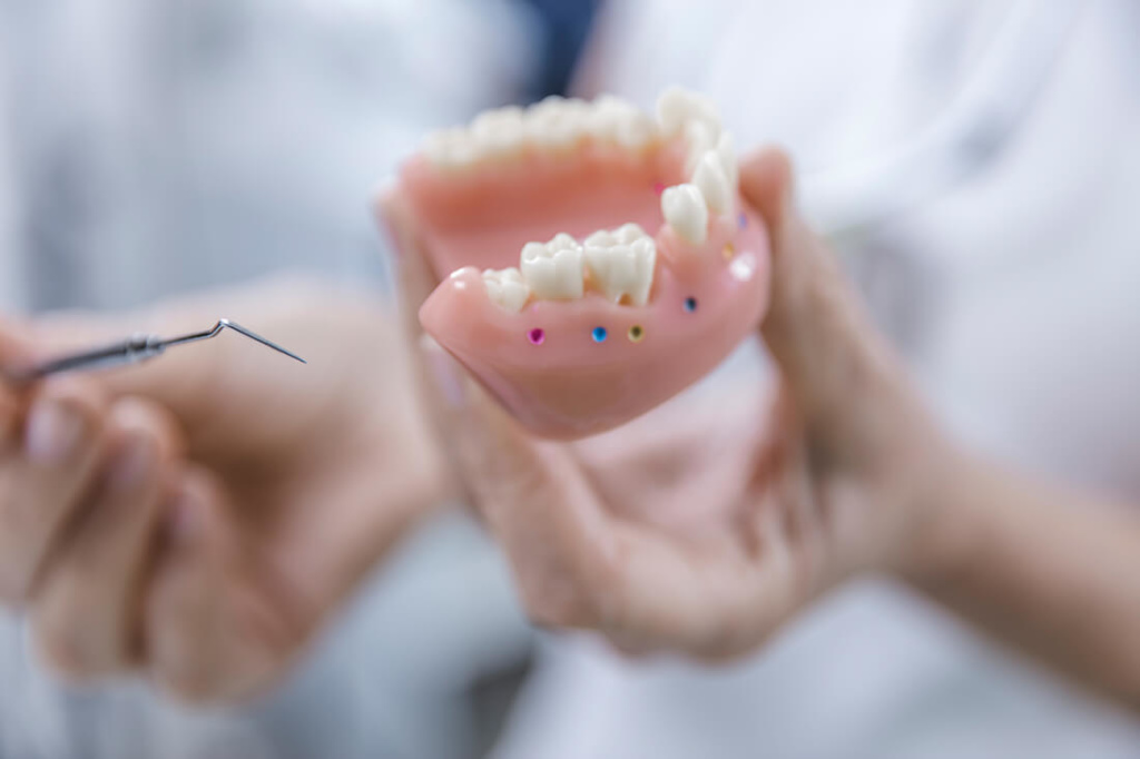 Zahnärztin Neuss - Sarem-Aslani - Hochwertiger Zahnersatz