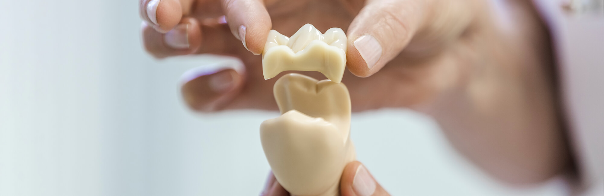 Zahnärztin Neuss - Sarem-Aslani - Slider Ästhetische Zahnheilkunde
